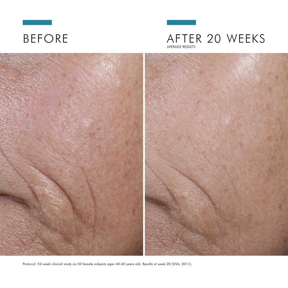 SkinCeuticals C E Ferulic® with 15% L-Ascorbic Acid - Geria Dermatology