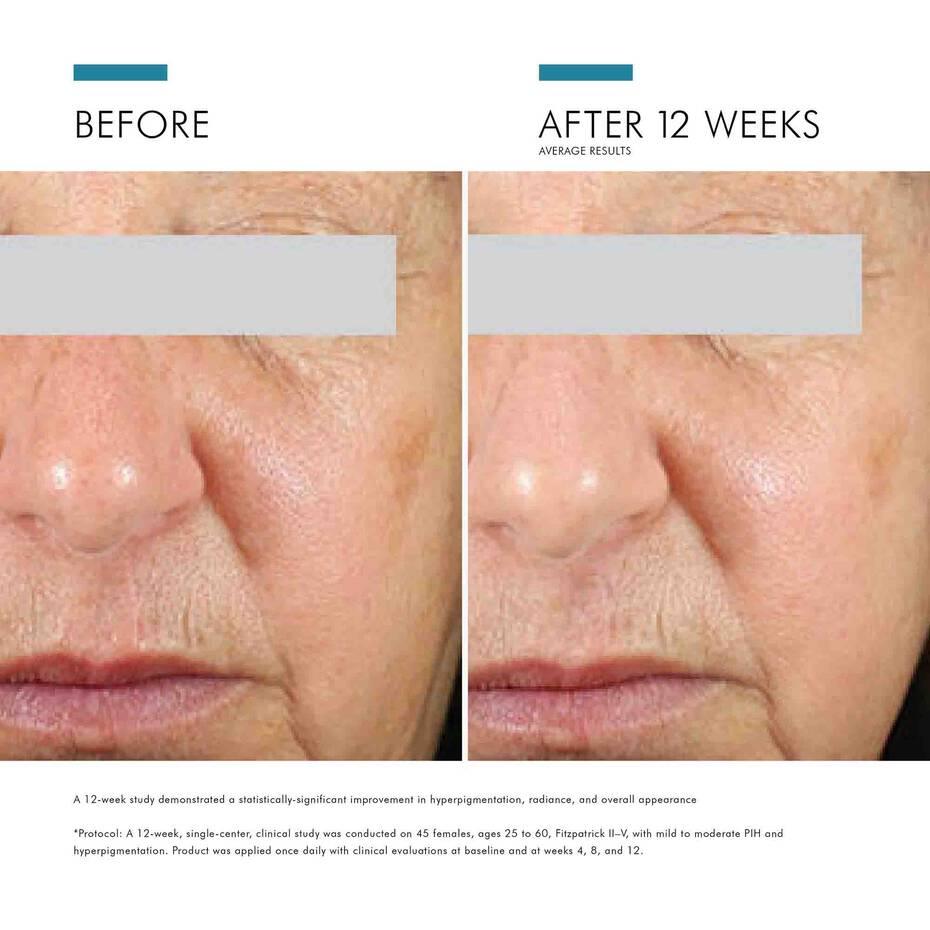 SkinCeuticals Daily Brightening UV Defense Sunscreen SPF 30 - Geria Dermatology