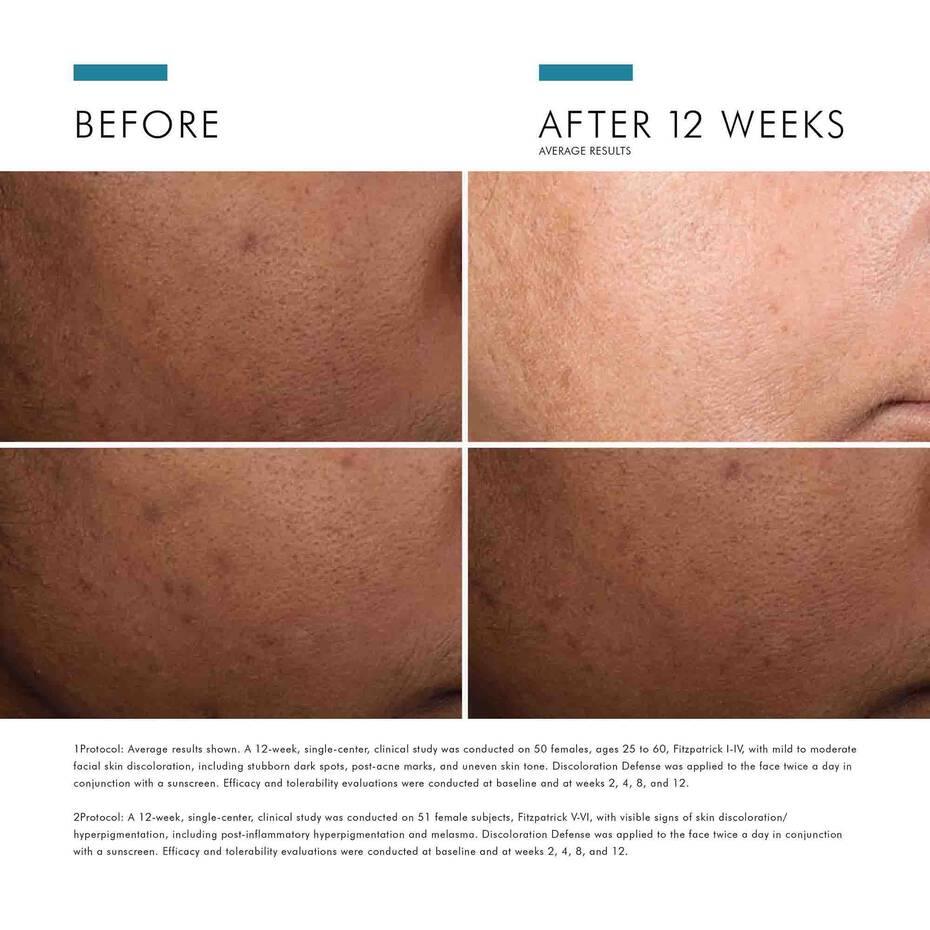 SkinCeuticals Discoloration Defense - Geria Dermatology