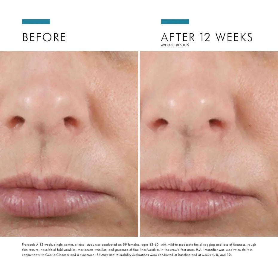 SkinCeuticals Hyaluronic Acid Intensifier (H.A.) - Geria Dermatology