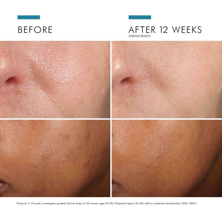 SkinCeuticals Phloretin CF® - Geria Dermatology