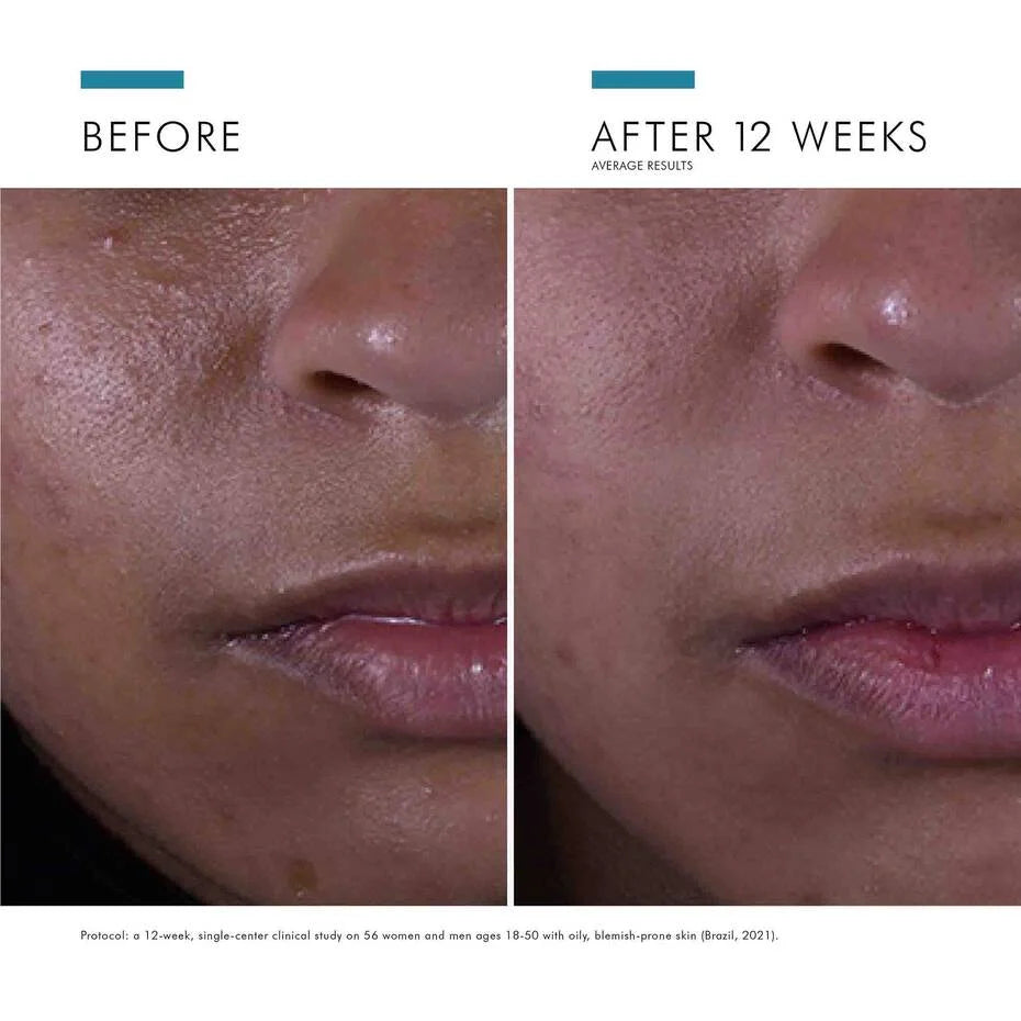 SkinCeuticals Silymarin CF - Geria Dermatology